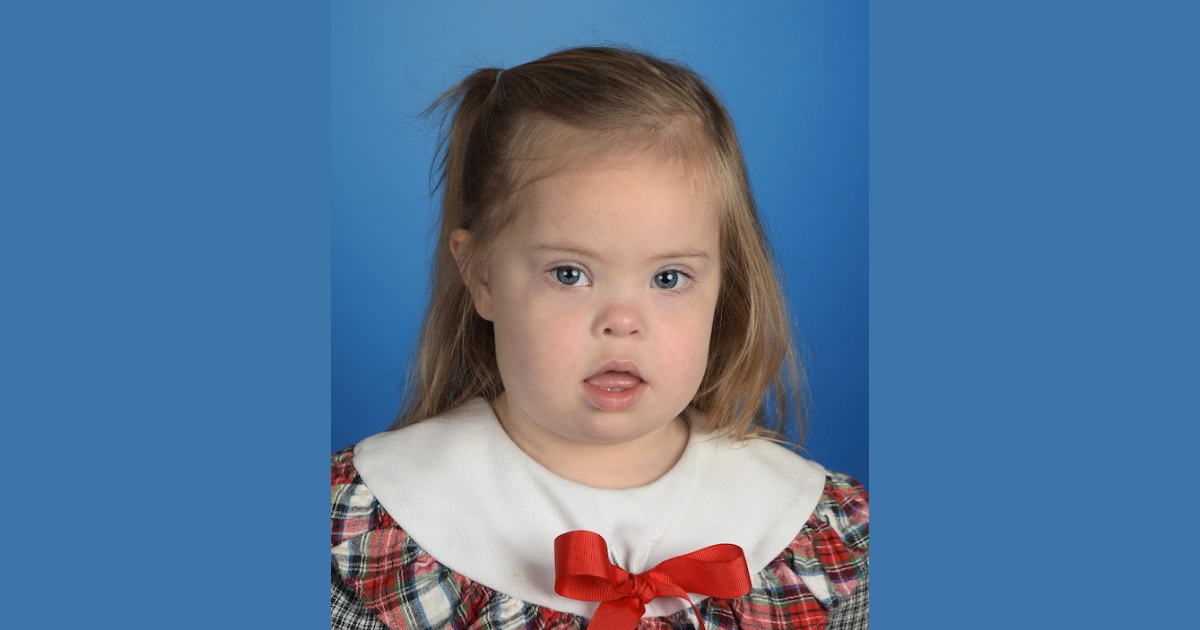 What Down syndrome teaches us about embracing our timeline
